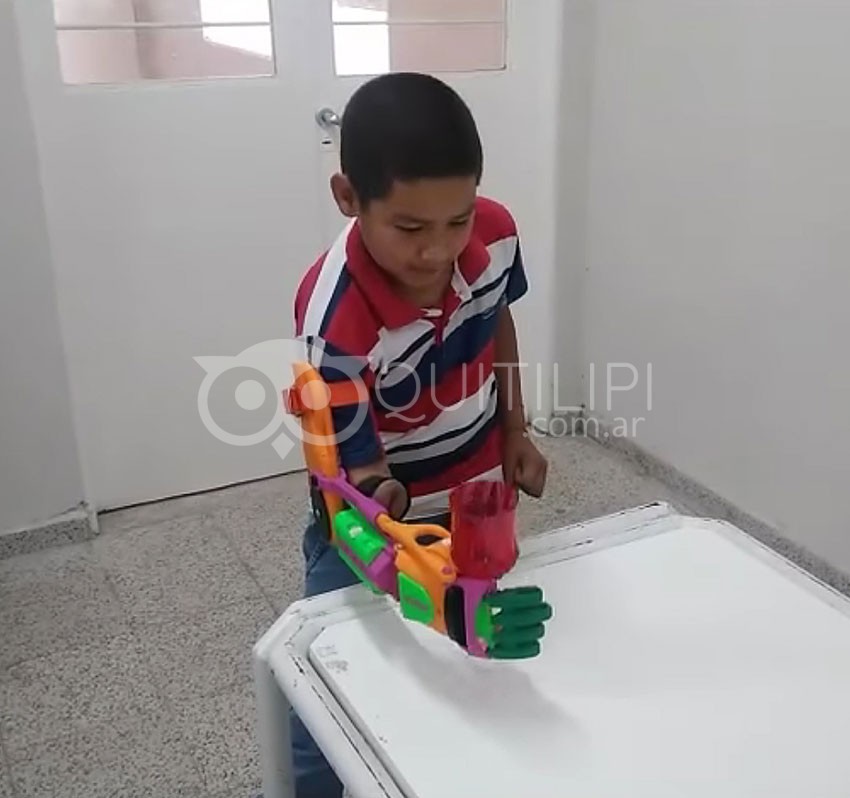 Escuelas Técnicas imprimen un brazo ortopédico en 3D para un niño de 10 años 2