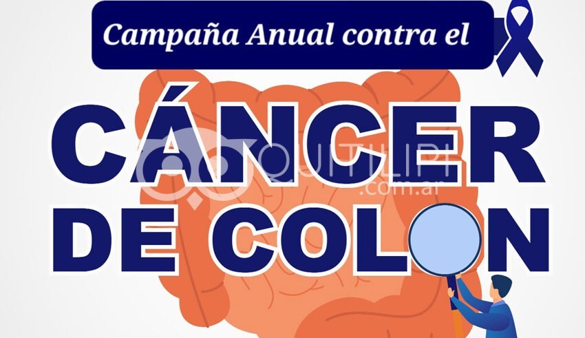 ALCEC y el Hospital de Quitilipi. Avanzan en la campaña anual de detección precoz de cáncer colorrectal 36