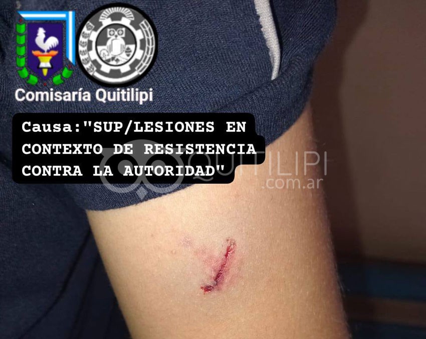 Robó un celular, cuando lo estaban por detener enojado agredió a dos agentes 19
