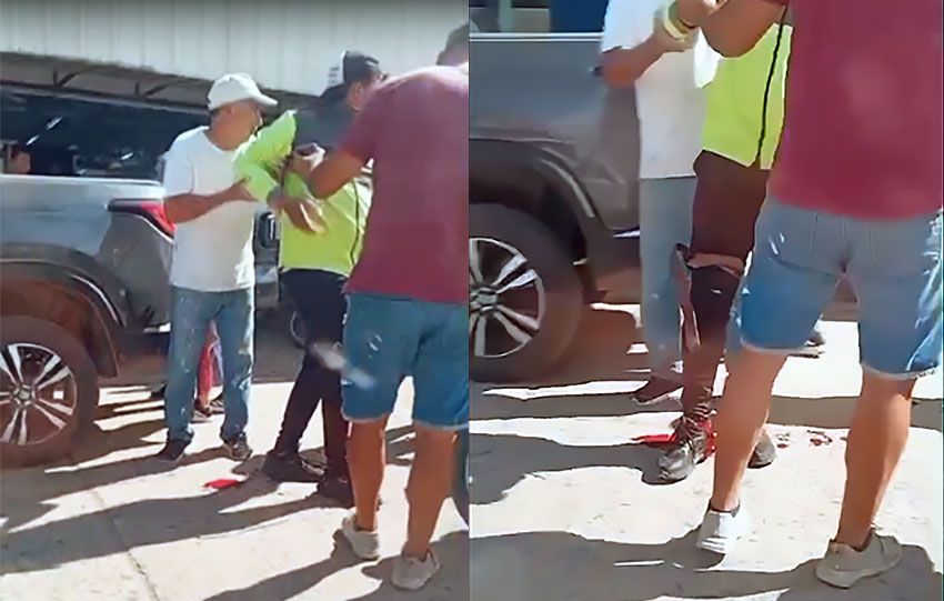 Le metió un tiro en la pierna a un inspector de tránsito y se dio a la fuga 7