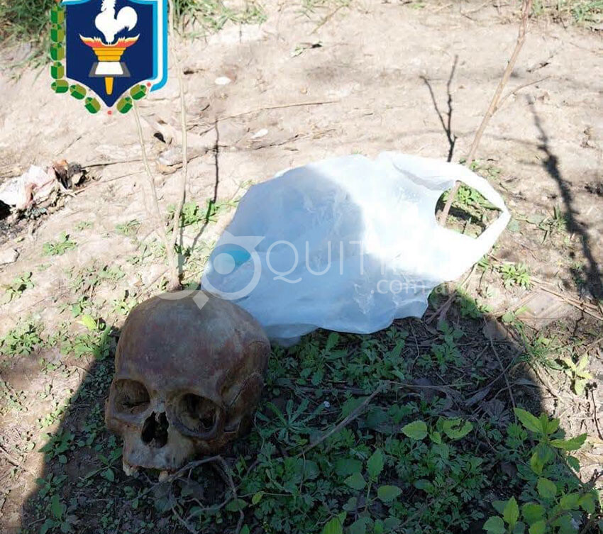 Conmoción en Quitilipi: un vecino buscaba leña en un basural y encontró un cráneo humano - Quitilipi.com.ar Conmoción en Quitilipi: un vecino buscaba leña en un basural y encontró un cráneo humano 15
